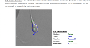IMSI Strict Morphology